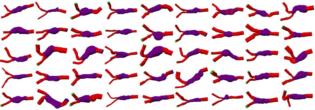Deep Learning gestützte Extraktion anatomischer Strukturen für Patient*innen-Kohorten am Beispiel von abdominalen Aortenaneurysmen.