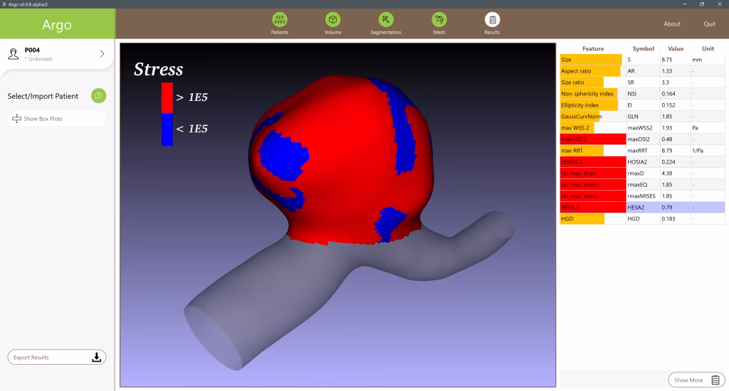 Abb. 8: Visualisierung von Bereichen der Gefäßwand mit besonders hoher mechanischer Spannung (rot).